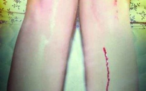 Los Campesinos!歌曲:There Are Listed Buildings歌词